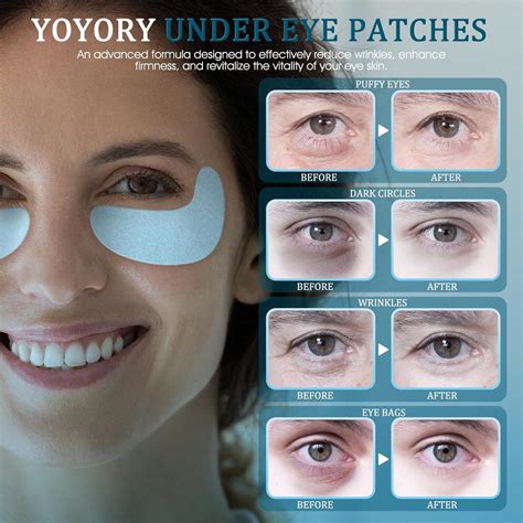 YOYORY Under Eye Patches Masks - for Dark Circles, India | Ubuy