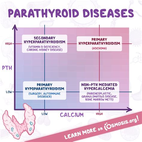 Primary Hyperparathyroidism Diagnosis, 50% OFF