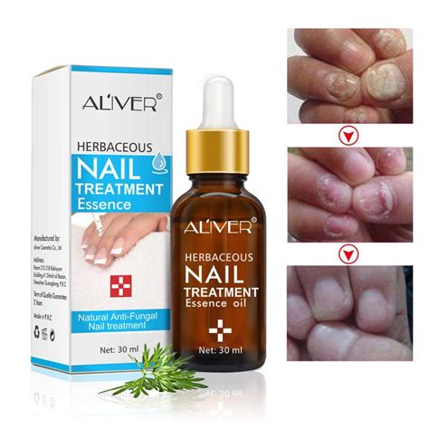 Buy Fungal Nail Repair Liquid Oil Onychomycosis Paronychia Anti Fungal ...