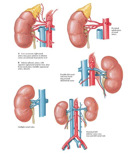 Variations in Renal Artery and Vein Anatomy - pediagenosis
