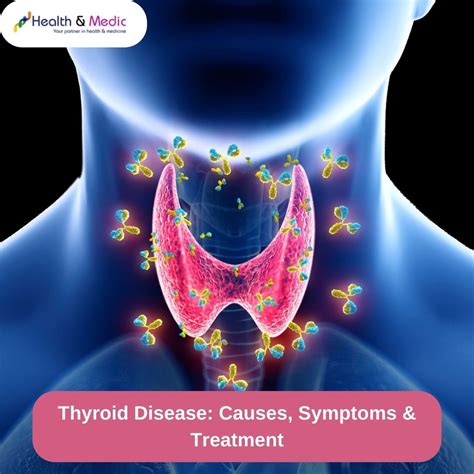 How is thyroid disease diagnosed?