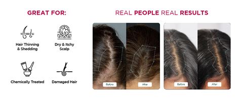 Soulflower Hair Growth Serum, Rosemary Oil, 3% Redensyl, 4% Anagain ...