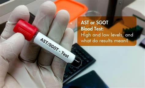 AST Blood Test 的图像结果