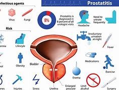 Image result for Prostatitis