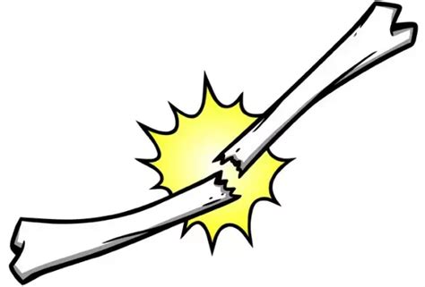 Double taper hydroxyapatite-coated implant tied to lower postoperative ...