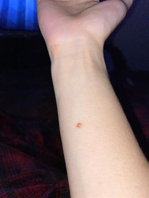 The first picture was 40 days ago. The second picture is right now. A ...