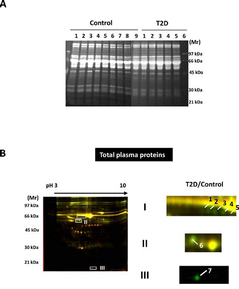 Image result for Post-Translational Modification of Insulin