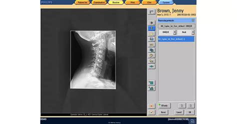 Philips - Eleva User interface for X-ray systems