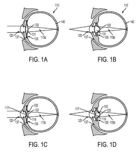 Google files patent for device that will be injected in your eye | Digit