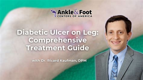 Diabetic Ulcer on Leg: Comprehensive Treatment Guide