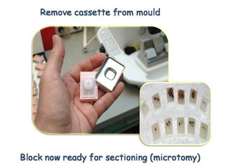Image result for Tissue Sample Receiving