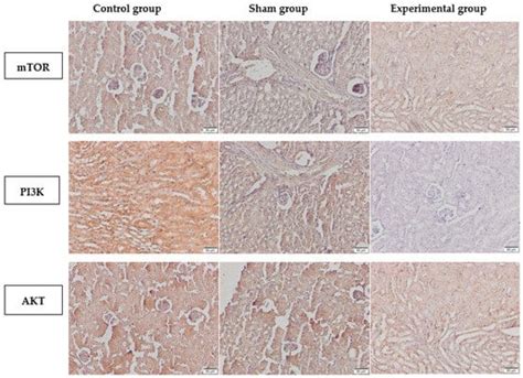 Cyclophosphamide Inhibits PI3K/AKT/mTOR Signaling Pathway in Mice Kidneys