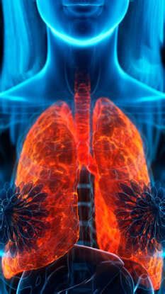 Top 5 Symptoms Of COPD You Must Know