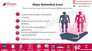 Image result for Biomedical Mini Projects Using MATLAB