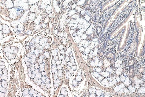 IHCeasy WWOX Ready-To-Use IHC Kit KHC0651 | Proteintech