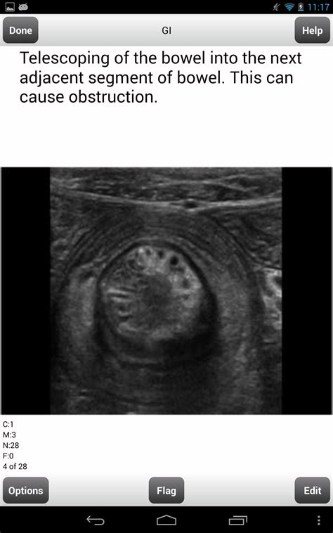 ARRT Sonography (Ultrasound) Flashcards Lite:Amazon.in:Appstore for Android