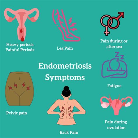 Do Endo Cysts Go Away at Louise Mcmakin blog