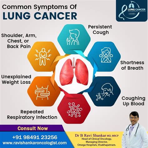 Common symptoms of lung cancer – Artofit