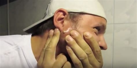 Image result for Worst Exploding Pimple