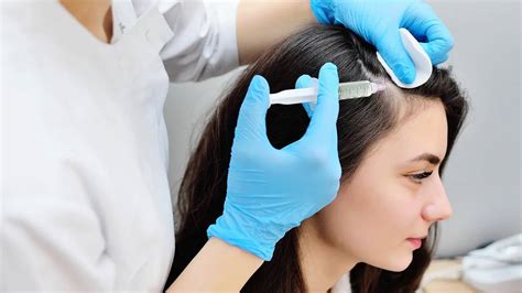 Hair Loss in Bournemouth? Why PRP Treatment Is the Best Solution
