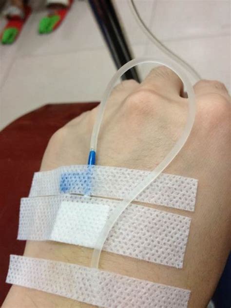 求一个男生输液手部图片 急_百度知道