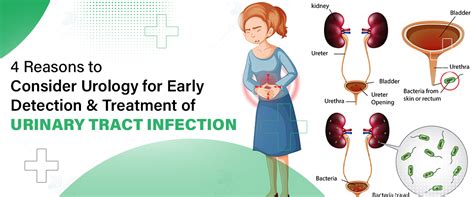 Urinary Tract Infection (UTI) Prevention -  Urinary Tract Infection (UTI) - Urology Channel