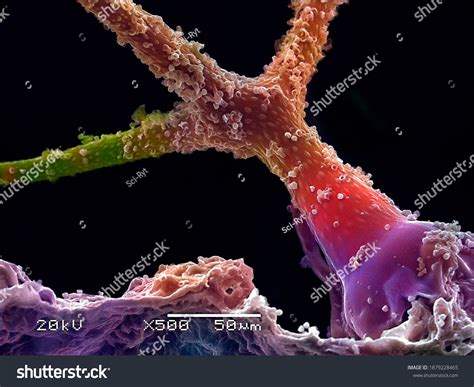 Scanning Electron Micrograph 的图像结果