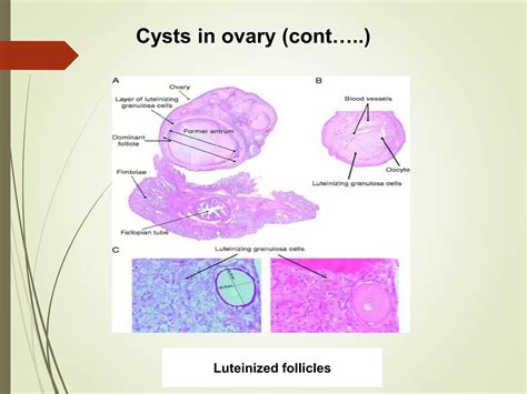 Image result for Female Reproductive System Disorders