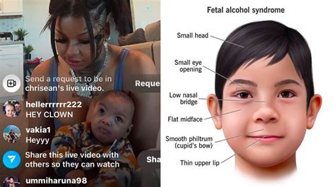 Blueface and Chrisean Rock’s Baby Fetal Alcohol Syndrome Theory | Know Your Meme