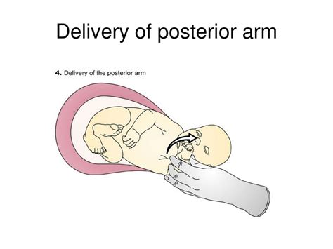 PPT - Shoulder Dystocia PowerPoint Presentation, free download - ID:9116642