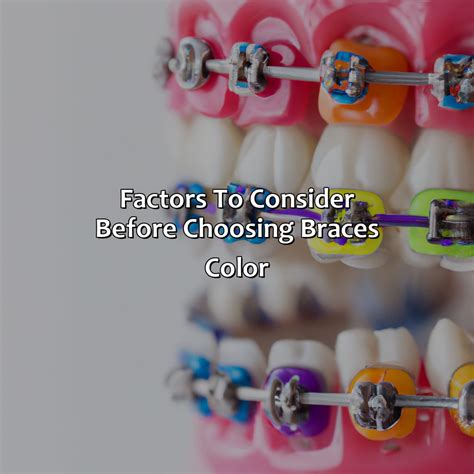 How To Choose The Best Color For Your Braces at Stephen Jamerson blog