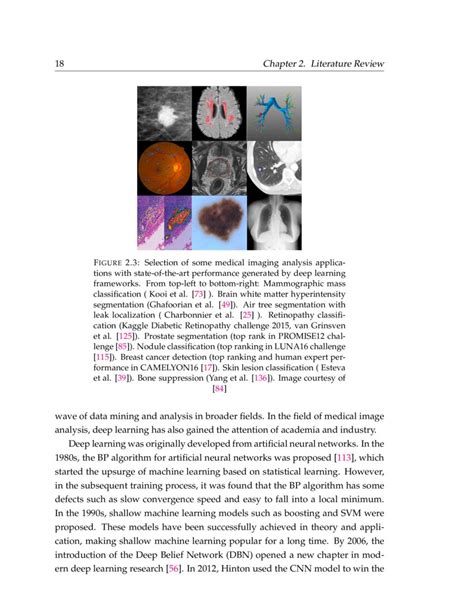 Image result for Deep Learning Algorithms in Medical Image Analysis