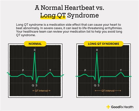 7 Medications to Avoid With Atrial Fibrillation - GoodRx
