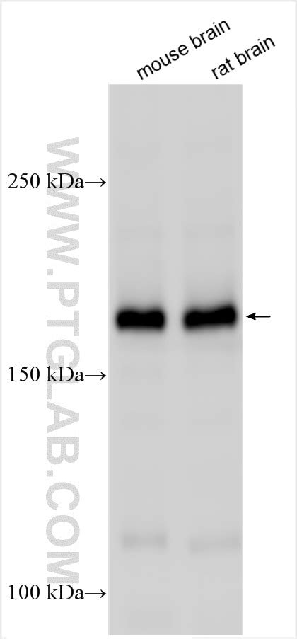 CASPR antibody (55417-1-AP) | Proteintech