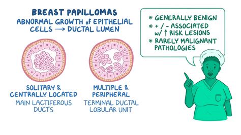 Video: Breast papilloma: Clinical sciences | Osmosis