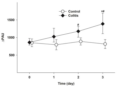 Conjugation with Tris Decreases the Risk of Ketoprofen-Induced Mucosal ...