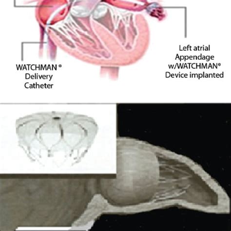 Image result for Video Watchman Device.com