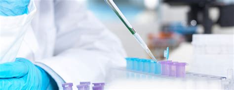 Carrier Testing for Cystic Fibrosis FAQ | UCSF Health