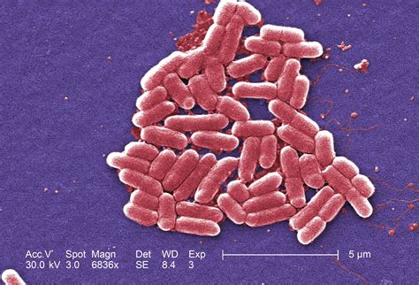E. coli | Pathogenic, Infection, Contamination | Britannica