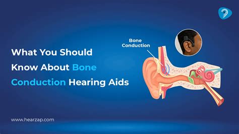 Bone Conduction Hearing Aids: Benefits, Types & Clear Guide