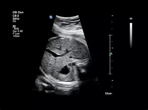 Philips - Affiniti 70 Ultrasound system - Philips