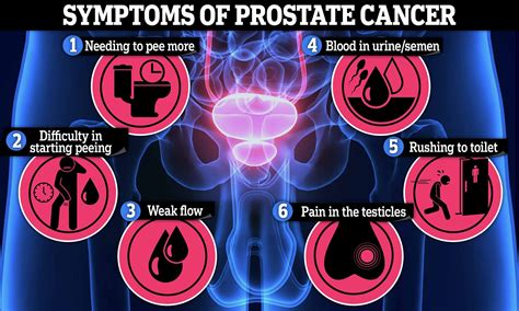 Prostate Cancer 的图像结果