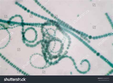 Anabaena Under Microscope
