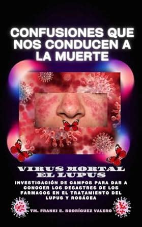 confusiones que nos conducen a la muerte: virus mortal el lupus ...