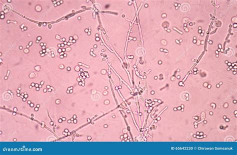 Branching Budding Yeast Cells With Pseudohyphae Stock Image | CartoonDealer.com #98176387