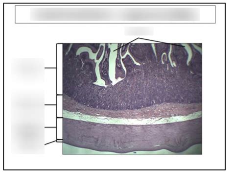 Image result for Small Intestine Jejunum