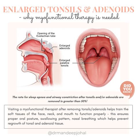 Adenoids And Tonsils Human Biology Structure Of Adenoids Biology