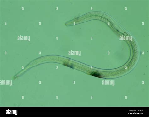 Helminths Parasites