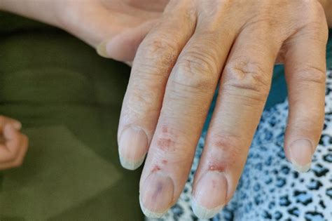 Snapping Turtle Bite 的图像结果