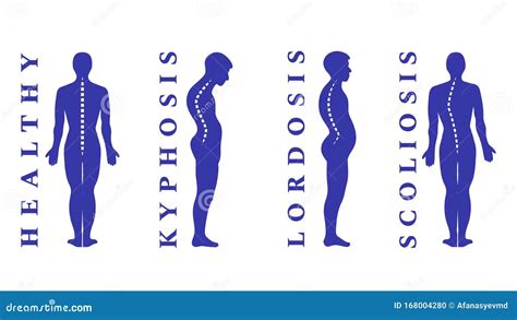 Different Types of Posture 的图像结果